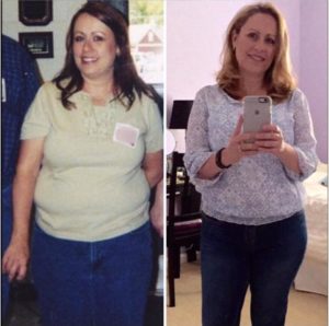 Paula's Story: One of the easiest things you've ever done - Dr. Bert ...